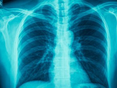 Ученые раскрыли тайну астмы, которая поражает женщин вдвое чаще, чем мужчин