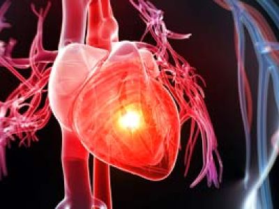 Гистерэктомия до 35 лет повышает вероятность сердечных заболеваний